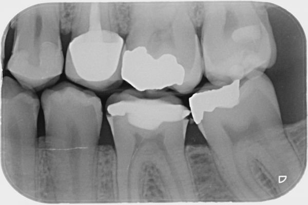 Radiografia 